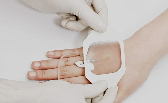 IV forbinding